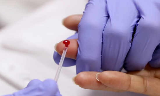 Saúde alerta sobre a prevenção contra HIV/Aids no Dezembro Vermelho