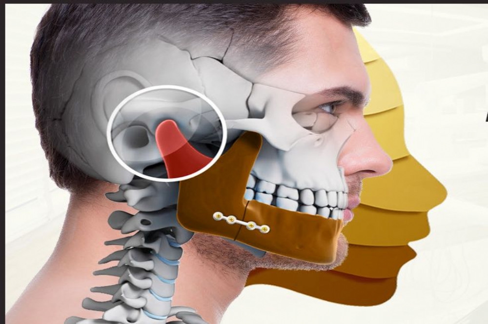 O que é Disfunção Temporomandibular? - Mega Imagem